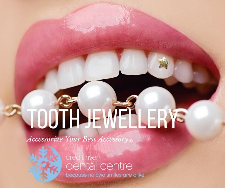 Gold Gems For Teeth Finest Selection